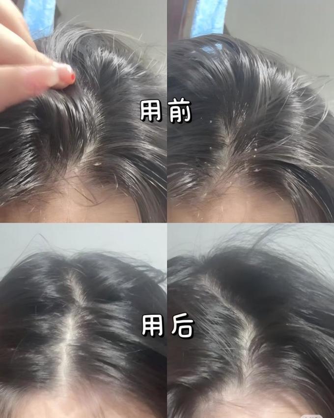 洗发产品