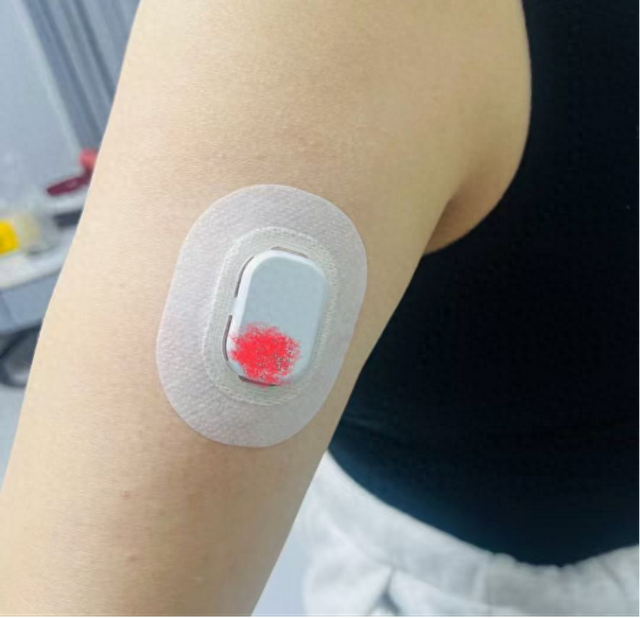 动态血糖仪的4大真相：张大爷险些酿成大祸的警示