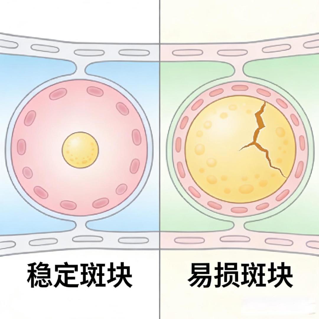 心电图正常≠心脏安全!中年人防猝死,体检别漏掉这些指标