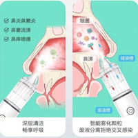 飞羊乐康洗鼻器是儿童鼻腔护理首选吗？627+用户观点大PK
