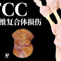 TFCC：三角纤维复合体损伤是哪里出问题了？