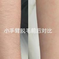 这几款脱毛仪不要选！2026脱毛仪推荐选购攻略