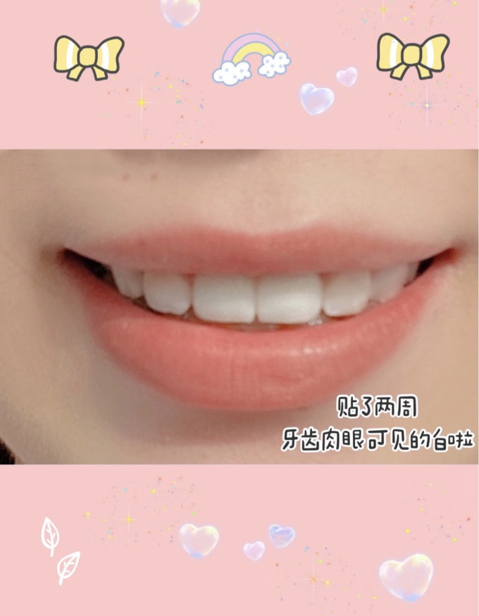 佳洁士牙齿美白