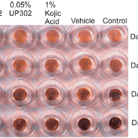 UP302不是万能美白神药，但对糖化暗沉和光电返黑的人真有用