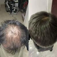 控油洗发水越洗越秃？这三款根本不该进浴室