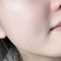 脸上爱出油还泛红敏敏的，如何低成本养好皮肤？芦荟水真的好用吗？5年油敏肌锐评一下最近风很大的寻荟记芦荟水