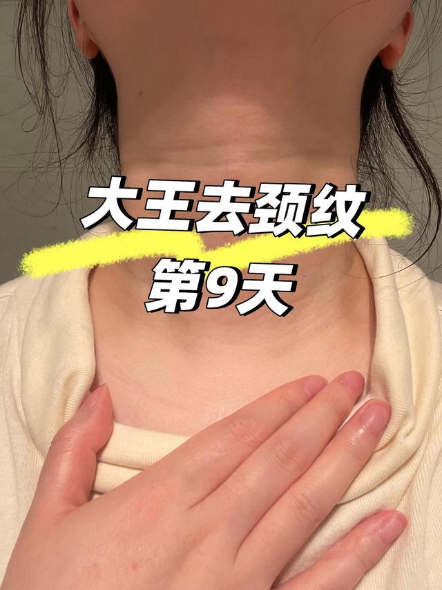 ｜去颈纹第9天｜今日面霜打底➕颈部按摩
