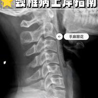 🌟十年颈椎病上岸指南🌟