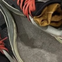 鞋子臭到“能自燃”?不要被误导,科学揭秘鞋子“臭到能燃”的真相