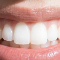 2026去牙渍美白牙膏实测，黄牙必看