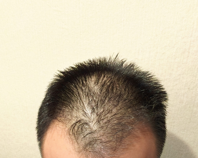 蔓迪日常用药