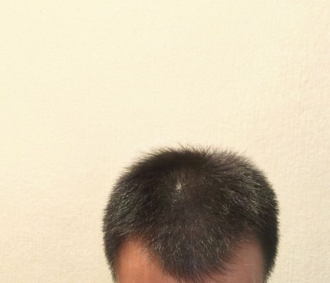 蔓迪日常用药