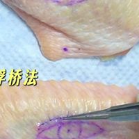 传统全切法vs浮桥法双眼皮，你能看出来差别吗？