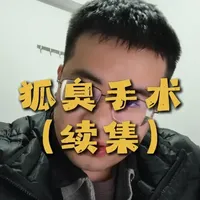 狐臭治疗避坑指南：中药喷剂靠谱吗？主流方案全解析