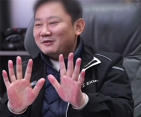 张雪手掌太红被提醒疑肝掌及时就医 网友回复堪称福尔摩斯