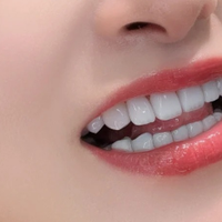 2026去牙黄美白牙膏实测，告别黄牙黑牙