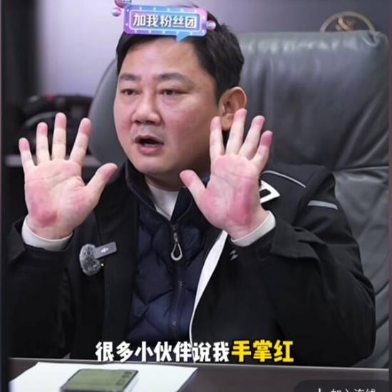 张雪手掌红得发紫！反复被网友提醒及时就医！生怕是第二个张雪峰