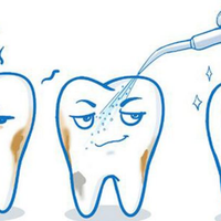 冲牙器不是智商税，但八成人根本用不着