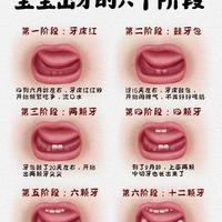 婴幼儿出牙全程指南：6个阶段特征与护理要点