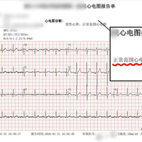 从大背包到小贴片，Holter还可以这样？