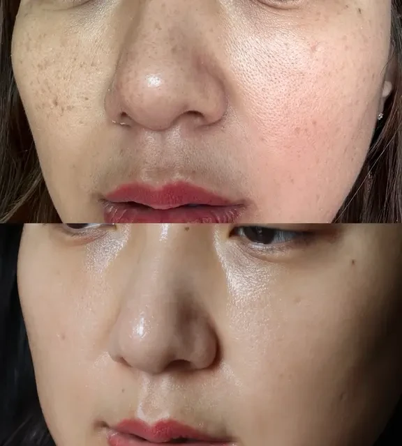用了6年的A醇脸，怎么放大A醇的抗老能力