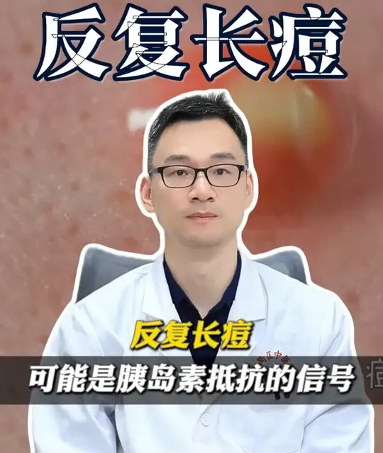 反复长痘警惕胰岛素抵抗，从代谢角度改善皮肤问题