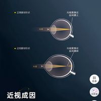 为啥娃的眼镜这么贵?一文看懂儿童防控镜片✨