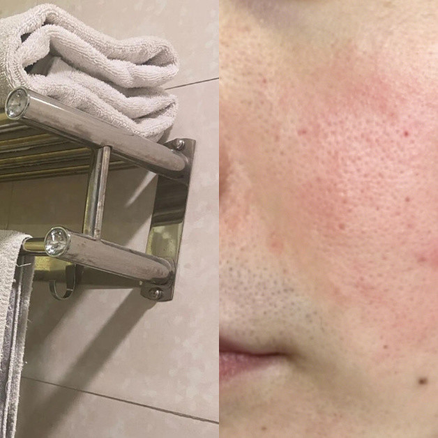 这次毛巾事件之后，我不太敢用酒店毛巾擦脸了
