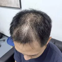 带秃顶男朋友来换新发型，这假发太隐形了