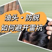 油头防脱猛怼米诺地尔，结果掉发也不见少，怎么这个坑你还在踩？