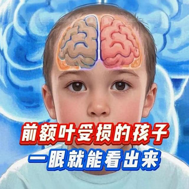 孩子总是停不下来？警惕“感官寻求”信号，科学应对更关键