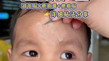 儿童伤口护理周期与减张贴、疤痕贴正确贴法指南