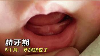 出牙期宝宝难带⁉️这套“原理+方法”亲测封神✅