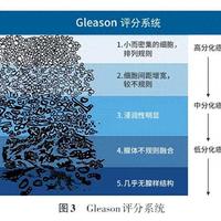 肠道掌管着人体70%的免疫 前列腺癌患者应该如何保持肠道的健康？