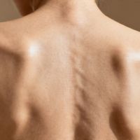 背不长痘、不脱屑、不僵硬!懒人抄作业:6大模块搞定背部护理终极指南