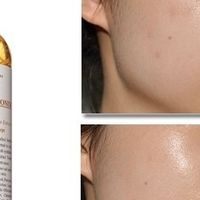 春日护肤重点：温和舒缓与控油