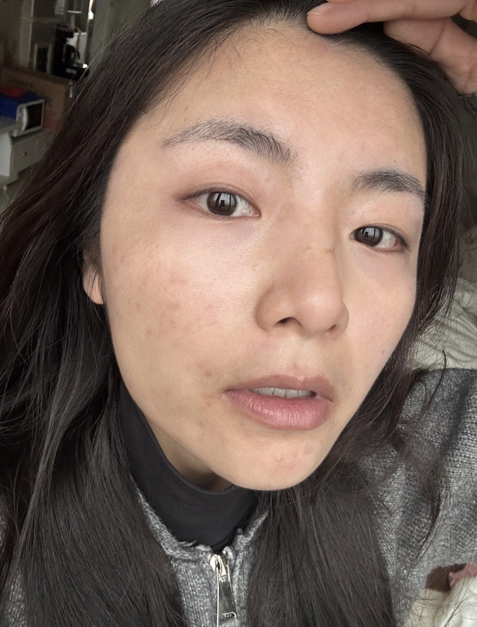 护肤精华