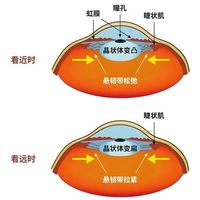近视不可逆，但眼睛可以更舒服！请牢记这6个习惯