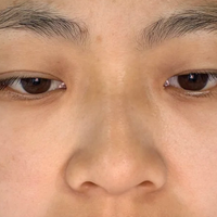 改善肤色不均用什么精华效果好？5 款热门精华成分拆解