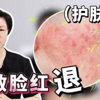 一到春天就脸红发烫刺痒？码住这份春敏自救指南（护肤篇）