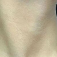 25+去颈纹用什么颈纹霜？达人分享，抗皱紧致淡纹