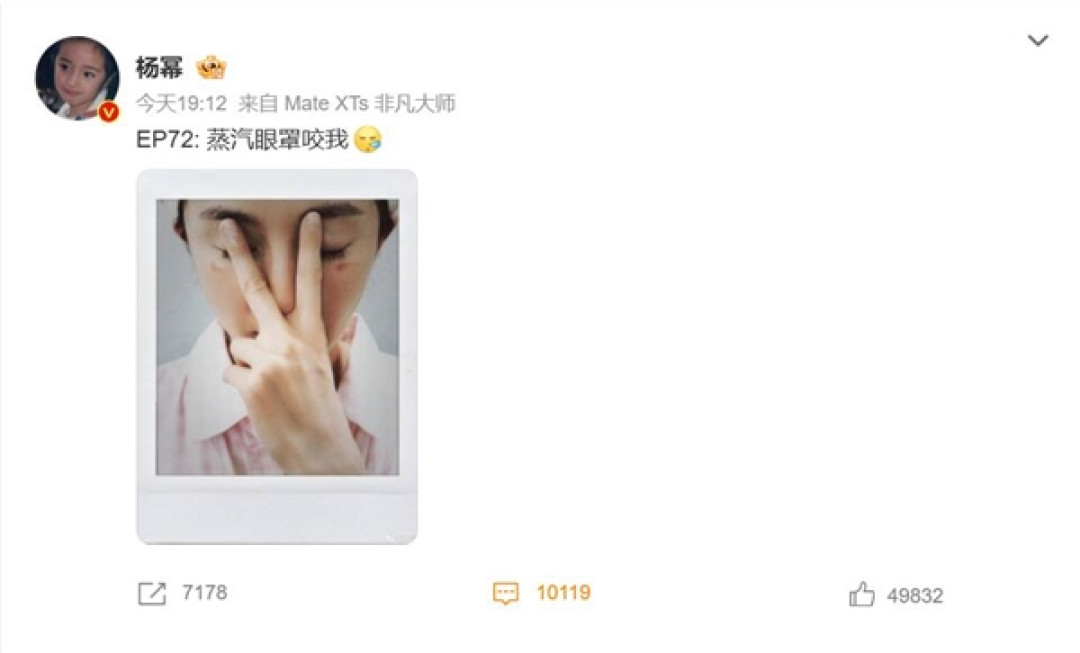 杨幂脸被蒸汽眼罩烫伤了:大家使用时要小心
