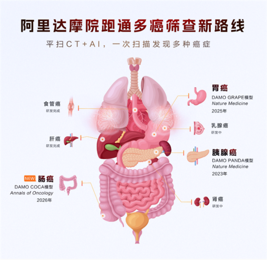 阿里发布第三个癌症AI模型:接连突破胰腺癌、胃癌、肠癌筛查难题
