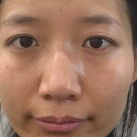 口碑好的晒后修护美白精华推荐，千元精华的成分对比拉出来看真相