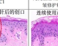 丸美重组胶原蛋白精华怎么样新一代丸美胶原小金针精华全维度测评