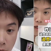 技术创新赋能日常护齿 俞浩力荐追觅NB01迈入全自动口腔护理时代