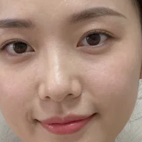 玫瑰痤疮恢复期党的敏肌美白笔记｜2 款无限回购款实力 PK