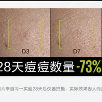 男士控油套装能收缩毛孔吗？毛孔粗大出油多用什么套装好？
