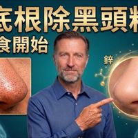 黑头粉刺洗不掉？柏格医生揭秘：这不是脏污！戒糖与「2大关键营养」助你从根源清除毛孔堵塞
