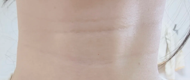 分阶抗皱精准淡纹！极博士麦角硫因颈纹霜实测，适配不同纹龄